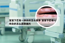宝宝下巴有一块白的怎么回事 宝宝下巴有一块白的怎么回事图片