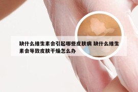 缺什么维生素会引起哪些皮肤病 缺什么维生素会导致皮肤干燥怎么办