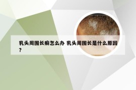 乳头周围长癣怎么办 乳头周围长是什么原因?
