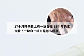 17个月孩子脸上有一块白呢 17个月的宝宝脸上一块白一块白是怎么回事