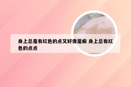 身上总是有红色的点又好像是癣 身上总有红色的点点