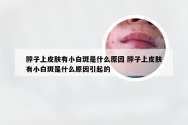 脖子上皮肤有小白斑是什么原因 脖子上皮肤有小白斑是什么原因引起的