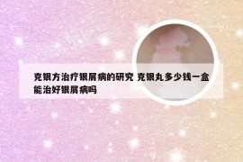 克银方治疗银屑病的研究 克银丸多少钱一盒能治好银屑病吗