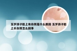 五岁孩子脸上有白斑是什么原因 五岁孩子脸上长白斑怎么回事