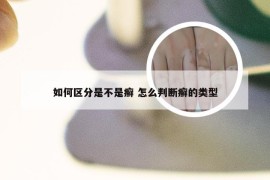 如何区分是不是癣 怎么判断癣的类型