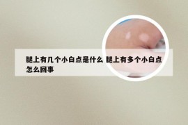 腿上有几个小白点是什么 腿上有多个小白点怎么回事