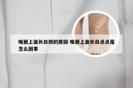 嘴唇上面长白斑的原因 嘴唇上面长白点点是怎么回事