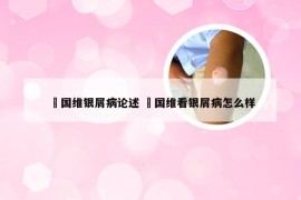 禤国维银屑病论述 禤国维看银屑病怎么样