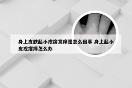 身上皮肤起小疙瘩发痒是怎么回事 身上起小皮疙瘩痒怎么办