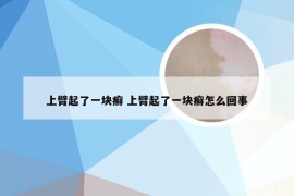 上臂起了一块癣 上臂起了一块癣怎么回事