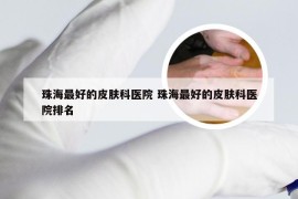 珠海最好的皮肤科医院 珠海最好的皮肤科医院排名