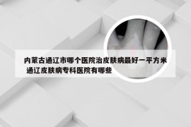 内蒙古通辽市哪个医院治皮肤病最好一平方米 通辽皮肤病专科医院有哪些
