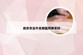 南京市治牛皮癣医院哪家好