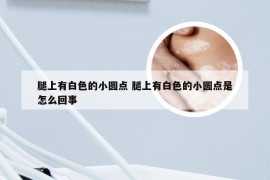 腿上有白色的小圆点 腿上有白色的小圆点是怎么回事