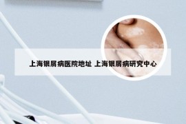 上海银屑病医院地址 上海银屑病研究中心