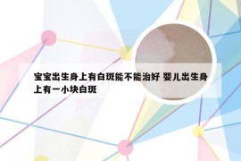 宝宝出生身上有白斑能不能治好 婴儿出生身上有一小块白斑