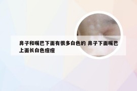 鼻子和嘴巴下面有很多白色的 鼻子下面嘴巴上面长白色痘痘