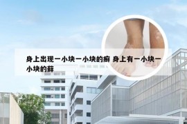 身上出现一小块一小块的癣 身上有一小块一小块的藓