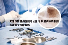 天津市银屑病医院地址查询 银屑病生物制剂天津哪个医院有吗