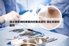 宿迁银屑病科哪里的好都选楚街 宿迁皮肤科医院