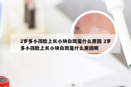 2岁多小孩脸上长小块白斑是什么原因 2岁多小孩脸上长小块白斑是什么原因呢