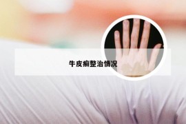 牛皮癣整治情况