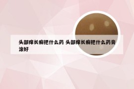 头部痒长癣把什么药 头部痒长癣把什么药膏涂好