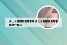 身上长圆圈癣但是不痒 身上长圆圈癣但是不痒用什么药