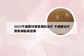 2023干细胞对银屑病的治疗 干细胞治疗银屑病临床进展