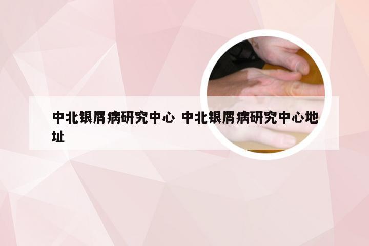 中北银屑病研究中心 中北银屑病研究中心地址